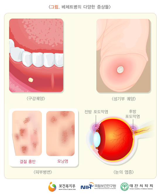 201101면역질환03