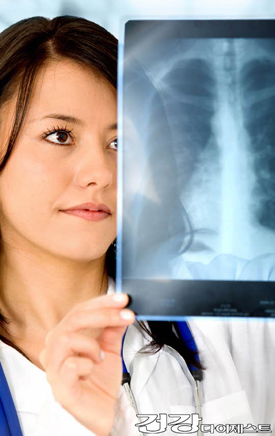 female doctor looking at a lungs or torso xray